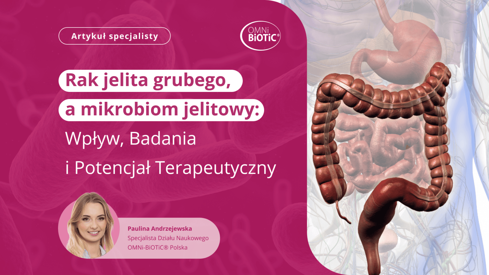 Artykuł OMNi-BiOTiC Polska Rak jelita grubego a mikrobiom jelitowy